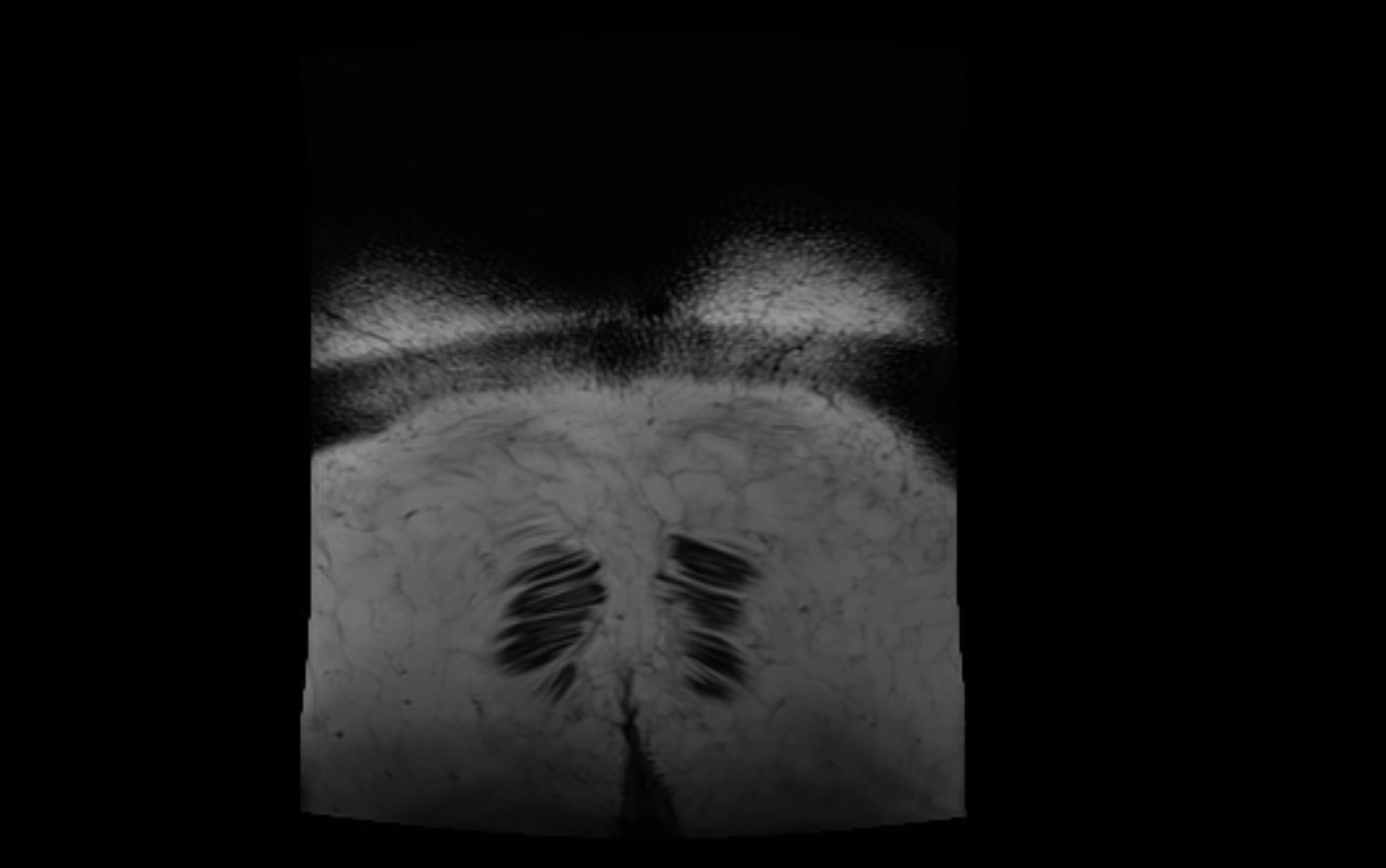 MR lumbosacral plexus cross sectional anatomy 3T  radiology  image-img-09001-00094.webp